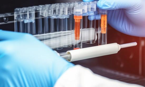 食品安全检测仪器的发展前景 2023食品安全检测仪器行业供需分析