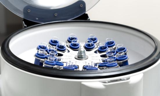 2023离心机行业现状及市场供需格局分析