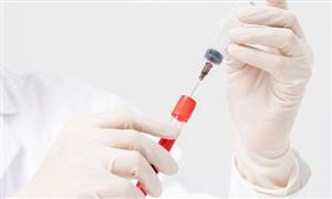 生物科研试剂行业市场调研分析 中国生化试剂行业投资前景预测2023