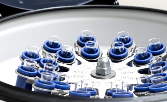 2023年离心机市场投资前景分析及供需格局研究预测