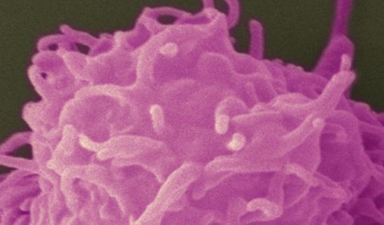 我国扫描电镜市场规模有望达到14.57亿元！中国扫描电镜行业发展现状2023