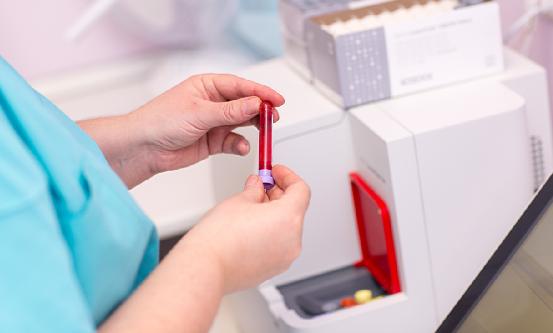 血气分析仪行业分析：血气分析仪逐渐朝着便携式、免维护、易操作等方向发展