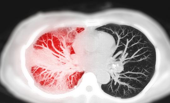 各大药企猛攻造影剂 中国造影剂行业投资趋势预测2023