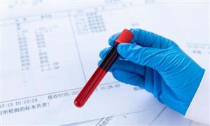 2023血液制品产业现状调研 国内血制品行业目前集中度较高