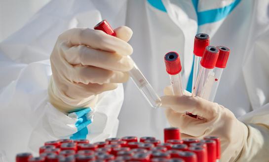 需求退潮，核酸检测企业走向何处去?在 2023年核酸检测行业市场发展现状