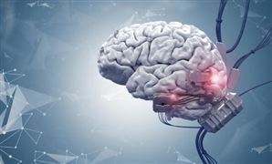 让瘫痪患者 开口说话 海外脑机接口迎来重磅突破 