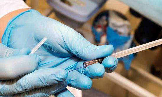 2023医用级聚乳酸市场分析 未来医用聚乳酸材料纯度有待进一步提升