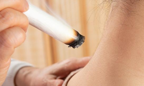 中国艾灸产业市场规模将达到887亿元 2023年中国艾灸条行业发展现状分析