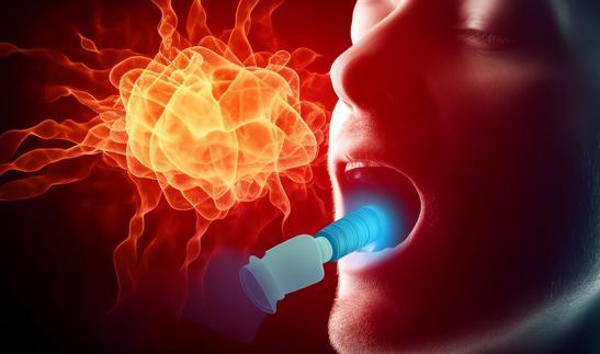 咽喉用药市场升级洗牌，知名度低的小品牌面临淘汰 2023年中国咽喉用药市场调研分析