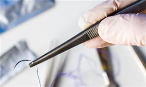 缝合线产业发展现状分析 缝合线产业市场调研