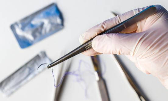 缝合线行业市场全景调研  未来将会研发出更多材质的手术缝合线