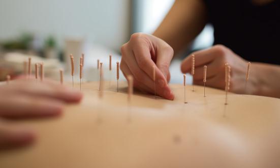 针灸行业市场深度分析及发展前景分析2023