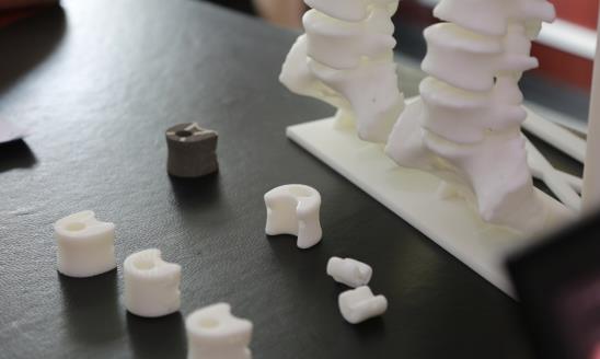 仿生骨行业发展现状及前景研究