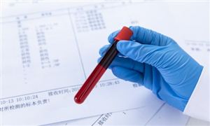 2023年中国血液制品行业竞争格局及前景分析