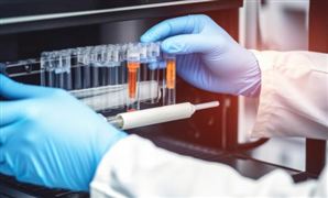 体外诊断产业预测 预计2024我国体外诊断市场规模将达1,957亿元