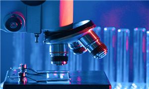 全球聚苯醚(PPO)市场规模如何 聚苯醚(PPO)市场前景分析