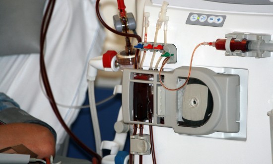 2023年国内血液透析机行业发展现状及发展趋势