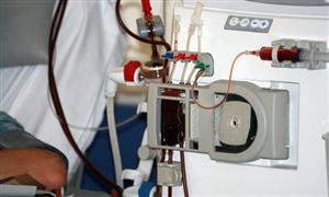 2023年国内血液透析机行业发展现状及发展趋势