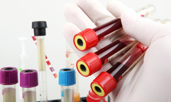 2023年国内人血白蛋白行业竞争格局分析及发展趋势