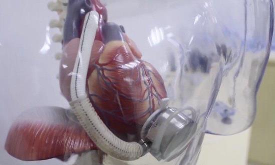 人工心脏市场深度分析：催生的下一个百亿级风口