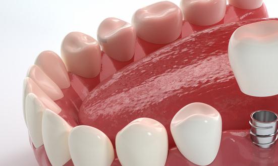 口腔设备行业前景：预计到2025年中国口腔科设备行业市场规模将达到860亿元