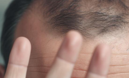 2024植发行业发展现状及市场发展前景分析