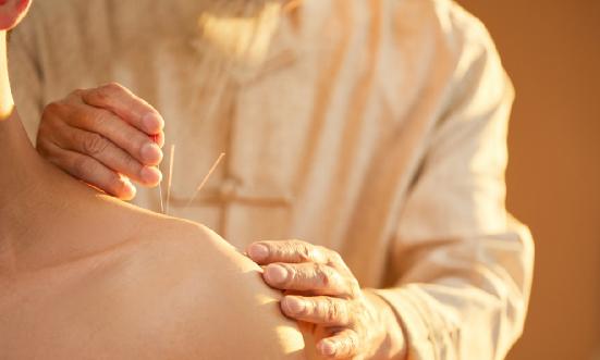 针灸行业市场现状及发展前景分析2024