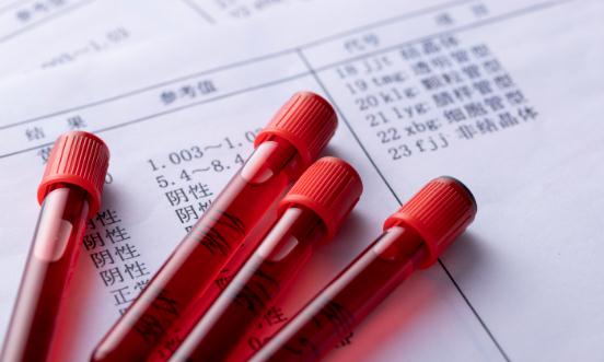 血液制品产业前景展望 未来行业的集中度会进一步提高