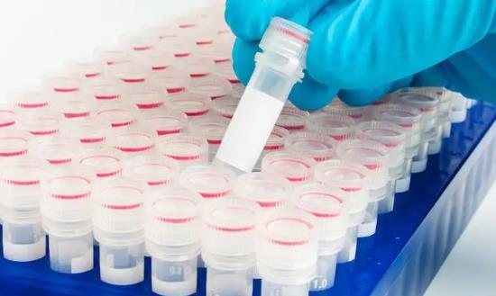 诊断试剂行业市场分析：到2024年我国体外诊断市场规模将达1957亿元