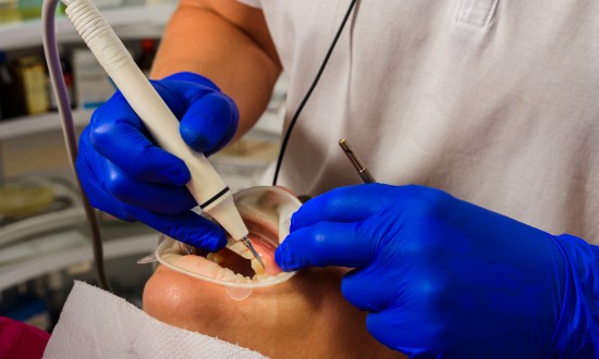 2024年中国超声波洁牙机行业的发展背景及竞争格局