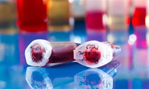 2024干细胞行业发展现状及市场运行态势分析