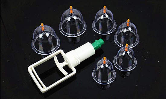 2024年中国真空罐治疗器行业产业链上下游结构及重点企业情况