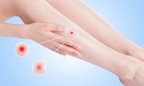 2024年中国皮肤病药物行业产业链的上下游结构及重点企业