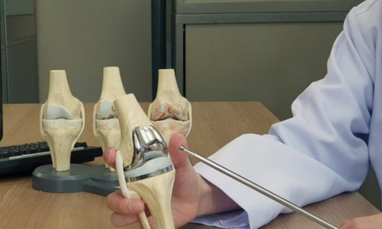 2024年中国人工关节行业产业链上下游结构及重点企业情况