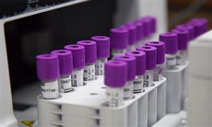 体外诊断仪器行业调研：2024年将是中国医疗器械出海大年