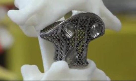 2024年植入材料行业的产业链分析及重点企业情况