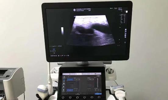 超声仪器行业发展趋势与机遇：超声仪器本土企业正在迅速崛起