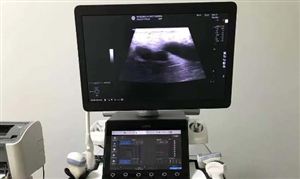 超声仪器行业发展趋势与机遇：超声仪器本土企业正在迅速崛起