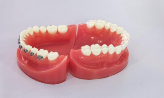 2024中国正畸托槽行业市场现状调研与投资战略研究分析