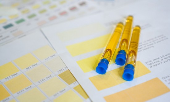 2024年尿液诊断产业链的上下游结构及发展趋势分析