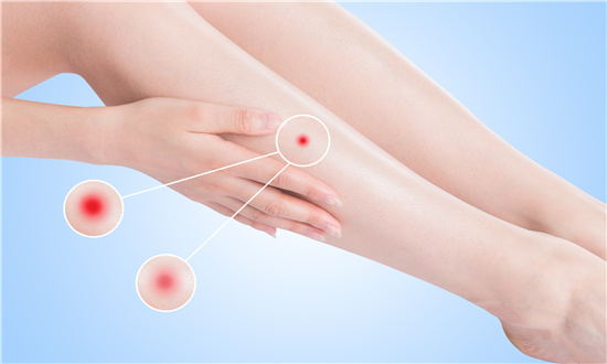 2024年皮肤病药物行业市场深度调查研究 预计到2026年皮肤病药物市场规模将达到227亿元