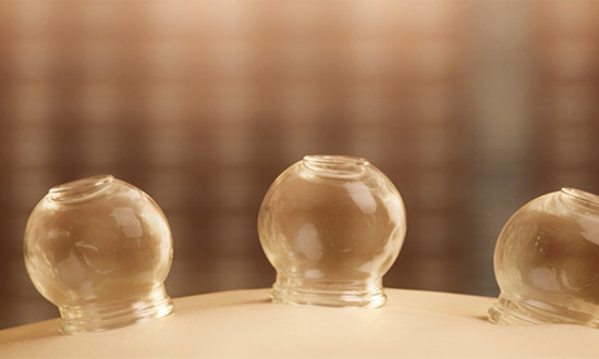 真空罐治疗器行业市场现状及未来发展前景分析