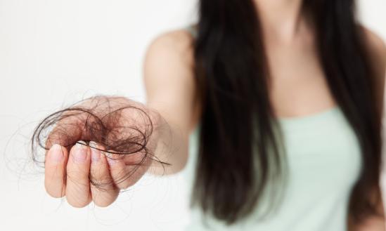 30岁前脱发的比例高达84% 毛发氨基酸行业分析