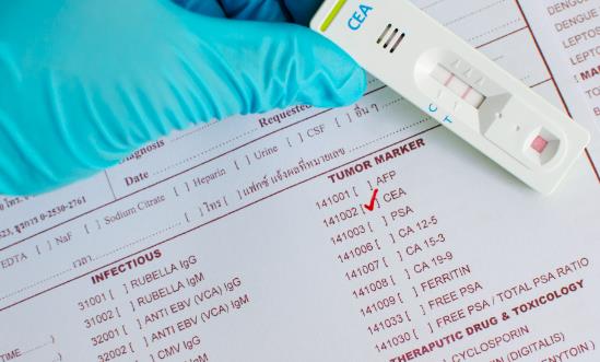 市场分析：预计到2029年全球癌症筛查市场规模将增至18496.74亿元