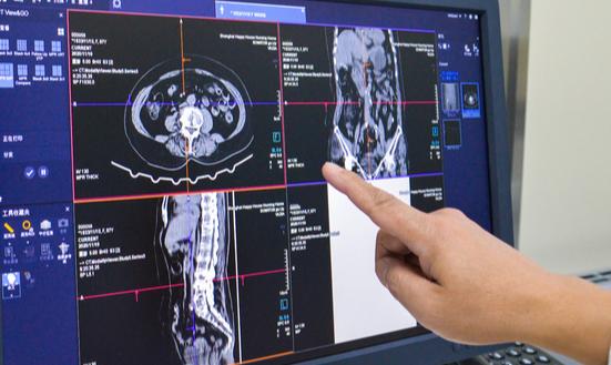 2024年中国医学影像设备行业现状、市场规模及未来发展趋势分析