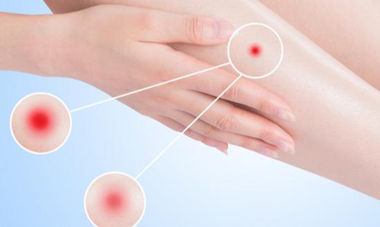 2024年中国皮肤病药物行业市场规模及未来发展趋势分析