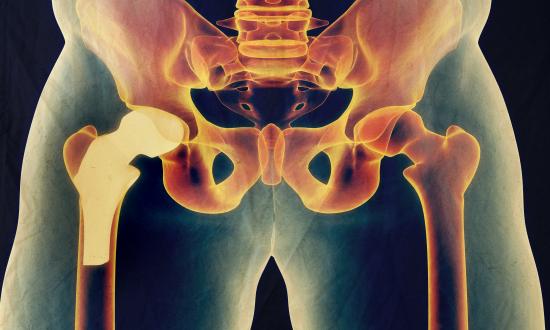 2025中国人工关节行业：重塑“膝”望，点亮“髋”心