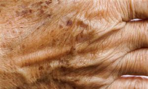 2025年祛斑行业深度分析：现状剖析、前景展望与趋势洞察