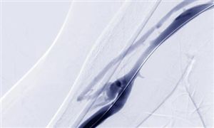 精对苯二甲酸（PTA）行业产业链及主要生产厂家、发展趋势与挑战分析