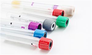 2026年真空管行业市场深度调研及发展前景预测